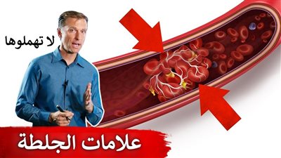 قبل الجلطة ب24 ساعة: علامات تحذيرية قد ينبهك لها جسمك