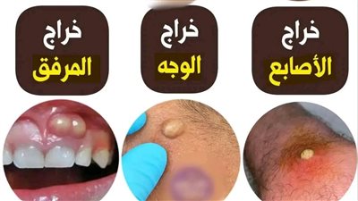 ما هو الخراج؟