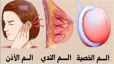 ألم الخصية الم الاذن و و العنين   والدوالي اعتلال أعصاب السكري
