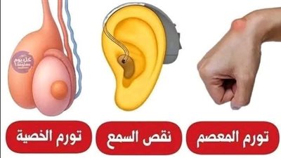 الأسباب وطرق العلاج لبعض الحالات الصحية الشائعة : كسور  تورم معصم 