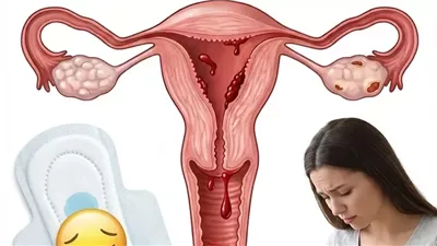 سبب نزول قطع تشبهه الكبــده