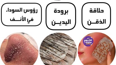 علامات جسدية شائعة تكشف خبايا صحتك وجمالك متى تكون طبيعية ومتى تستدعي القلق؟