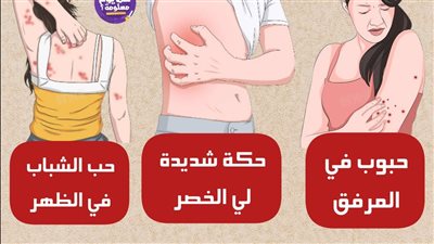 خريطة مشاكل الجلد الصامتة: لماذا يثور جسدك في مناطق مخفية؟ وما هي الرسائل التي يرسلها لك؟