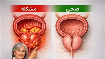 رسالة لكل رجل لا ينبغي لأحد أن يستسلم لسړطان البروستاتا اكتشف أقوى الأسلحة الطبيعية للوقاية والترميم!