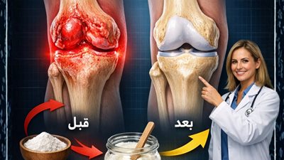 طبيب عظام يبلغ من العمر 97 عاماً يكشف طعام واحد فقط يعيد بناء غضروف الركبة خلال 24 ساعة