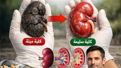 دليل مرضى الكلى للبروتين: 4 أنواع صديقة و6 أنواع عدوة  وما هو وضع الحمص؟
