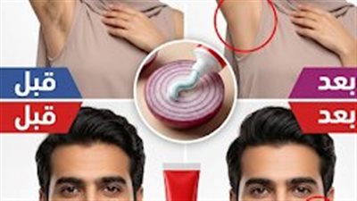 « بشړة ناعمة وملساء: ثورة إزالة الشعر الطبيعية في دقيقتين فقط! » ✨