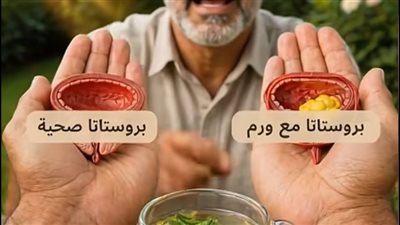 مُذيب احتقان الغدة: المشروب الساخن السيادي الذي يعيد السيطرة للبروستاتا وينهي آلام المسالك!