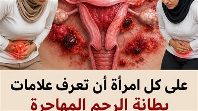 بطانة الرحم المهاجرة: الدليل الشامل لفهم الأعراض، الأسباب، والحلول العلاجية