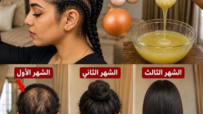 الكنز الخفي في مطبخك كيف تحول البصل والثوم إلى أقوى علاج منزلي لتساقط الشعر؟