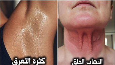 هندسة التشخيص الذاتي وبروتوكولات العلاج المنزلي (2026)