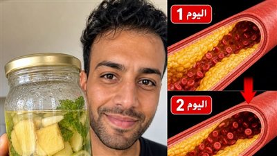 درع الشرايين”: الحقيقة العلمية لتنظيف الأوعية الدموية والوقاية من الجلطات (2026)
