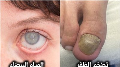 «بروتوكولات العناية الذاتية»: حلول هندسية لمشاكل شائعة (دليل 2026)